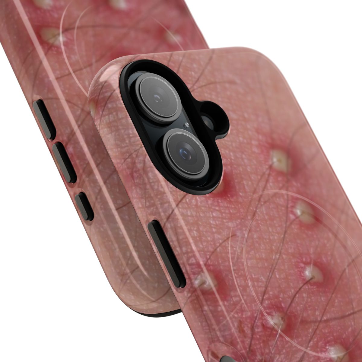 Pimple skin design on a tough, magnetic phone case - Detail