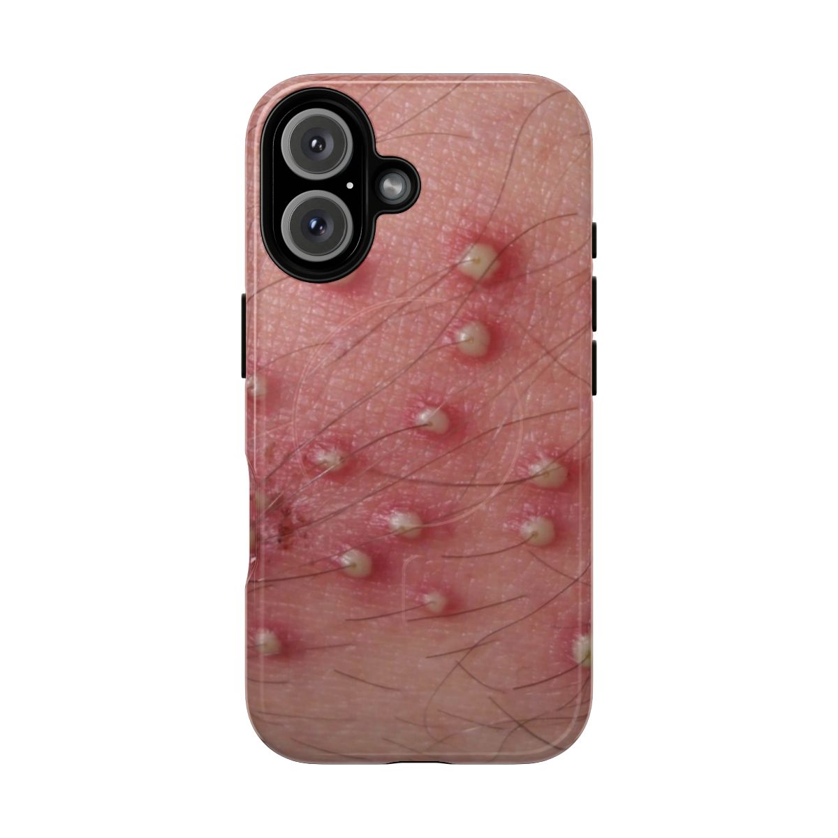 Pimple skin design on a tough, magnetic phone case