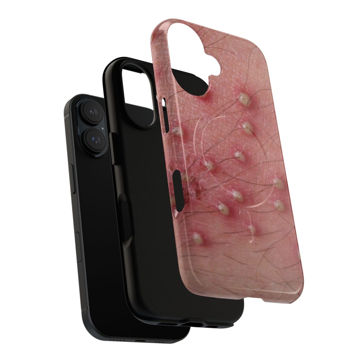 Pimple skin design on a tough, magnetic phone case - Layers